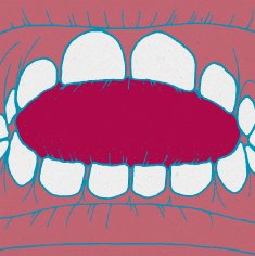 tongue-thrust