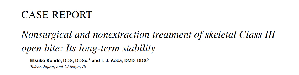 Nonsurgical and Nonextraction Treatment of Skeletal Class III Open Bite: It's Long-Term Stability